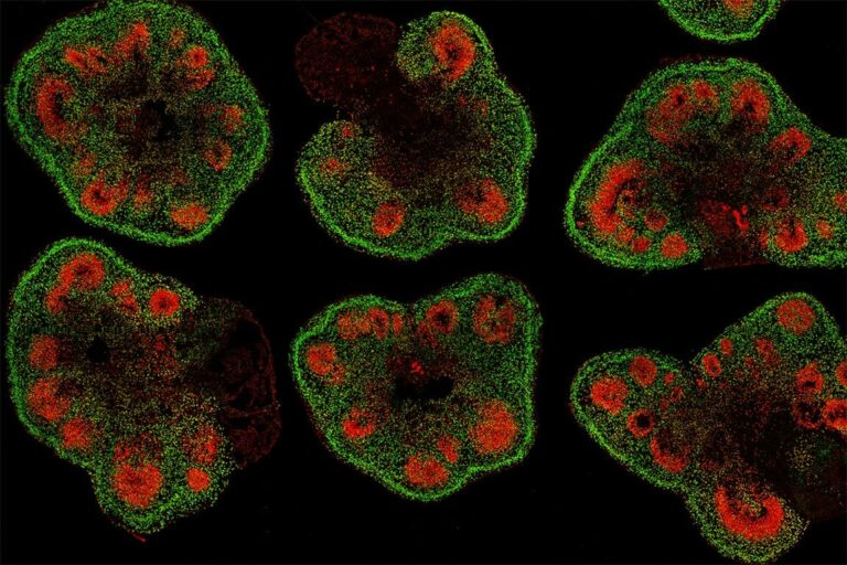 Making Labgrown Brain Organoid Brainier